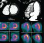 CORE320 study published: CTA-CTP evaluated against ICA+SPECT